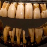 The Wooden Teeth That Weren't